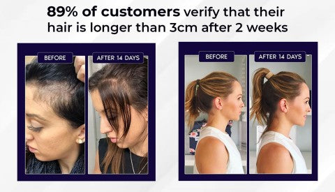 🌿LAST DAY OFFER – 50% OFF🌿 Dougparmo™ Natural Hair Growth Spray