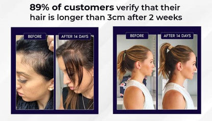 🌿LAST DAY OFFER – 50% OFF🌿 Dougparmo™ Natural Hair Growth Spray