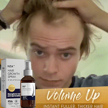 🌿LAST DAY OFFER – 50% OFF🌿 Dougparmo™ Natural Hair Growth Spray