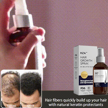 🌿LAST DAY OFFER – 50% OFF🌿 Dougparmo™ Natural Hair Growth Spray