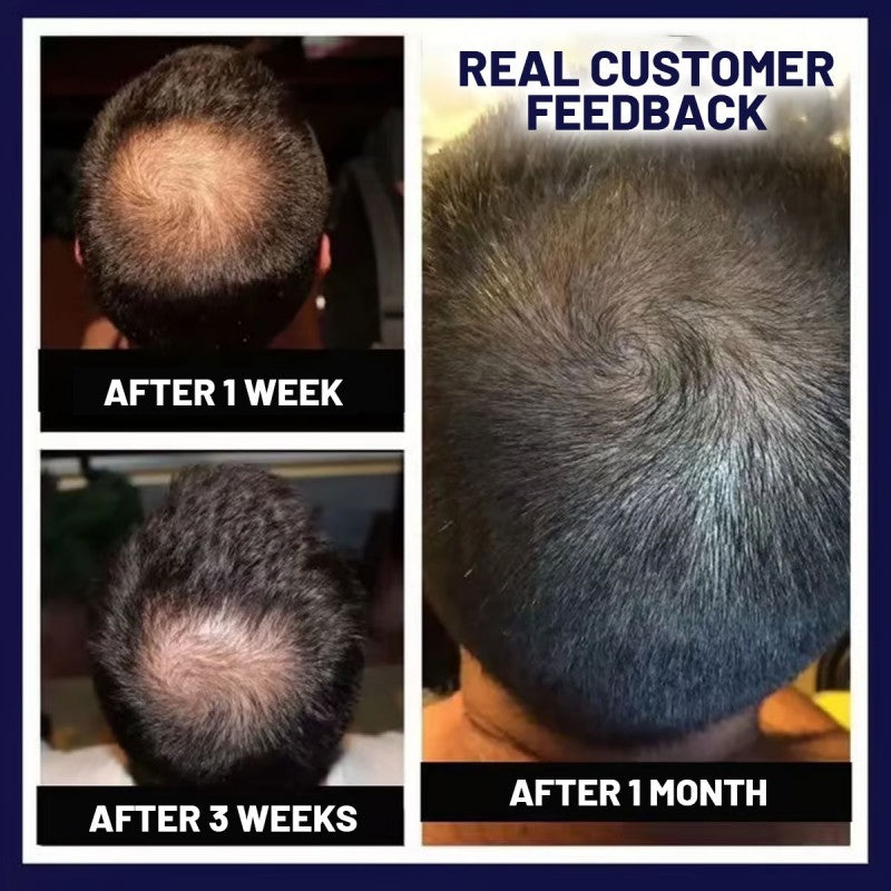 🌿LAST DAY OFFER – 50% OFF🌿 Dougparmo™ Natural Hair Growth Spray