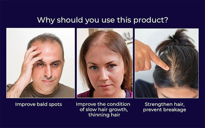 🌿LAST DAY OFFER – 50% OFF🌿 Dougparmo™ Natural Hair Growth Spray