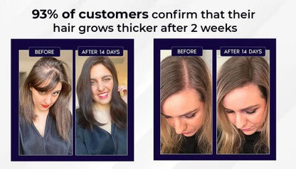 🌿LAST DAY OFFER – 50% OFF🌿 Dougparmo™ Natural Hair Growth Spray