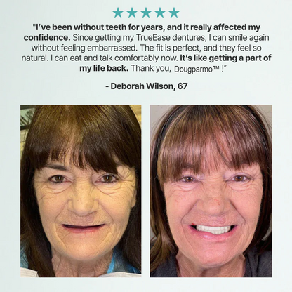 Limited Smile Today: 70% OFF! Dougparmo™ Custom-Fit Full Functional Dentures Make your smile more confident