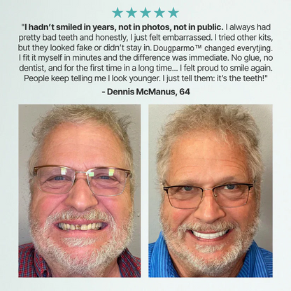 Limited Smile Today: 70% OFF! Dougparmo™ Custom-Fit Full Functional Dentures Make your smile more confident