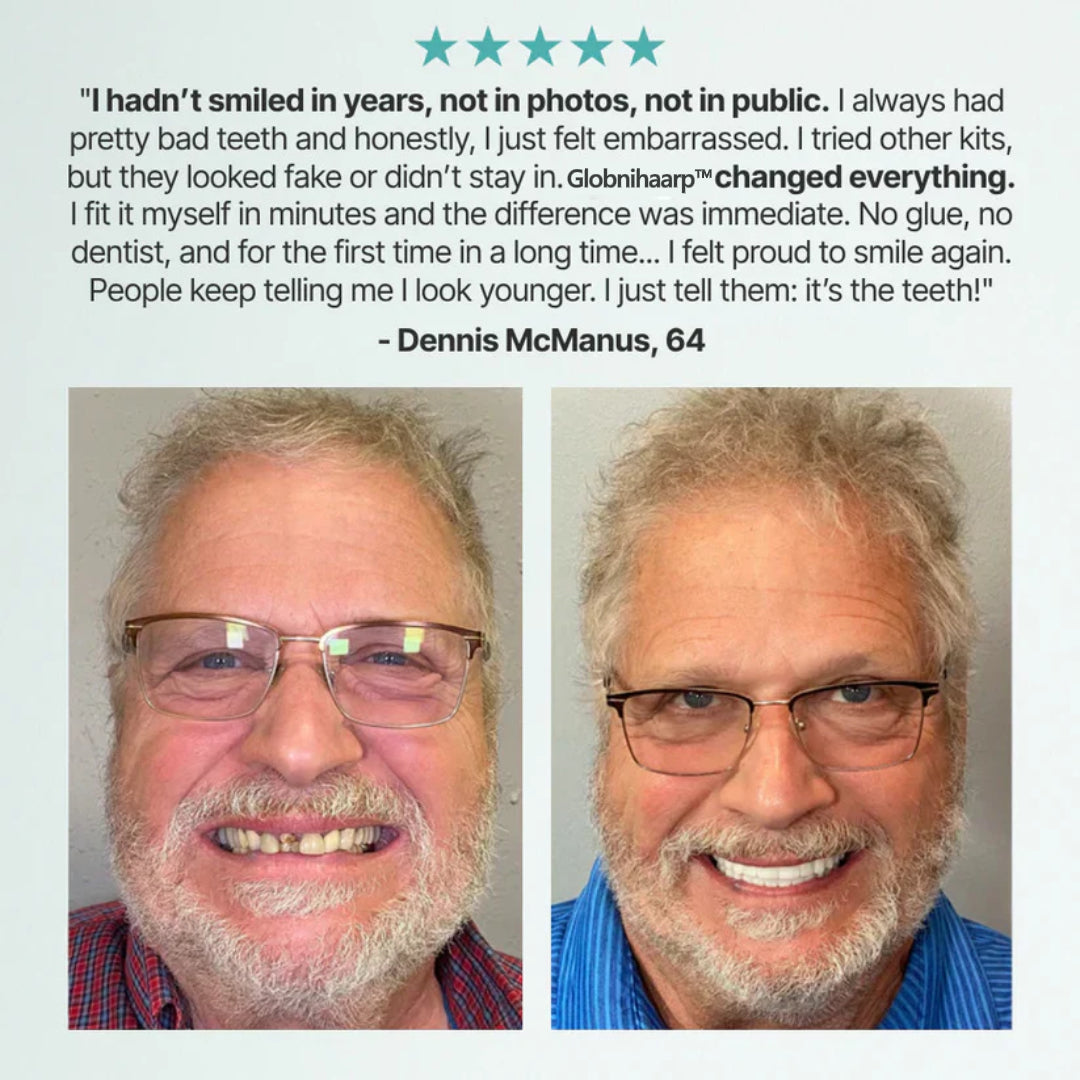🌎Ends Today: 70% OFF! ⏰Globnihaarp™ Medical Full Denture with Strong Suctiond