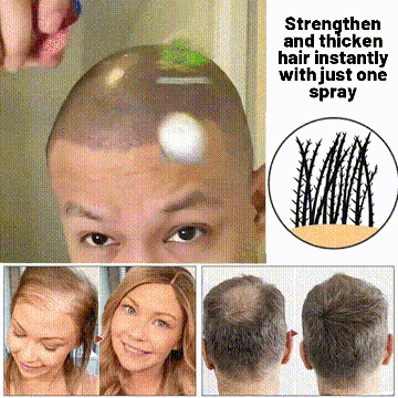 🌿LAST DAY OFFER – 50% OFF🌿 Dougparmo™ Natural Hair Growth Spray